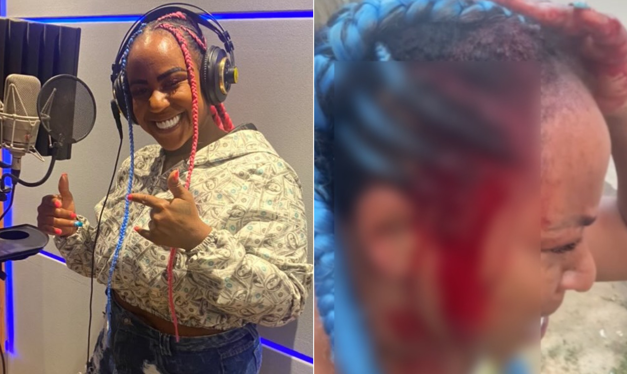 Saiba quem é a cantora de funk que denunciou agressões do namorado MC e mostrou ferimentos nas redes