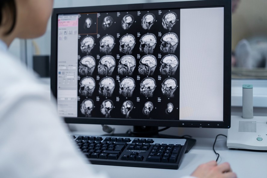 IA permite que um volume crescente de dados possa ser analisado
