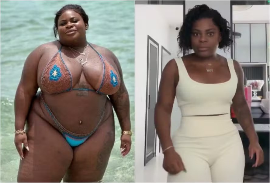 Jojo Todynho utilizou o medicamento mounjaro para ajudar a manter o resultado após perder mais de 80 quilos com uma cirurgia bariátrica e mudanças no estilo de vida — Foto: Reprodução/Instagram