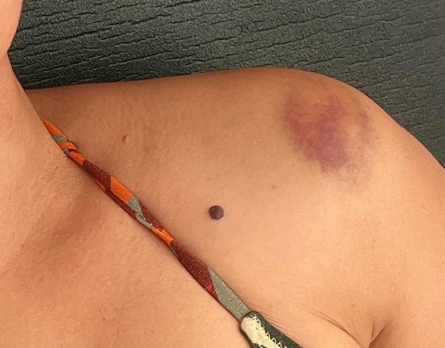 Primeiro-ministro de Portugal se cala enquanto polícia é violenta com manifestantes, incluindo brasileiros - Foto