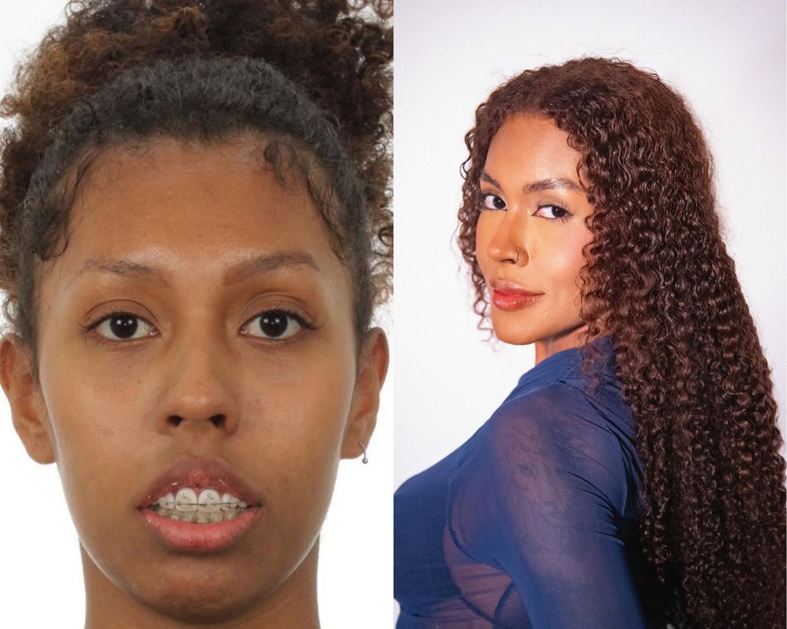 Antes E Depois Giovanna Jacobina