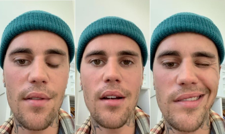 O cantor Justin Bieber publicou um vídeo no Instagram em que falou sobre o diagnóstico da síndrome de Ramsay Hunt
