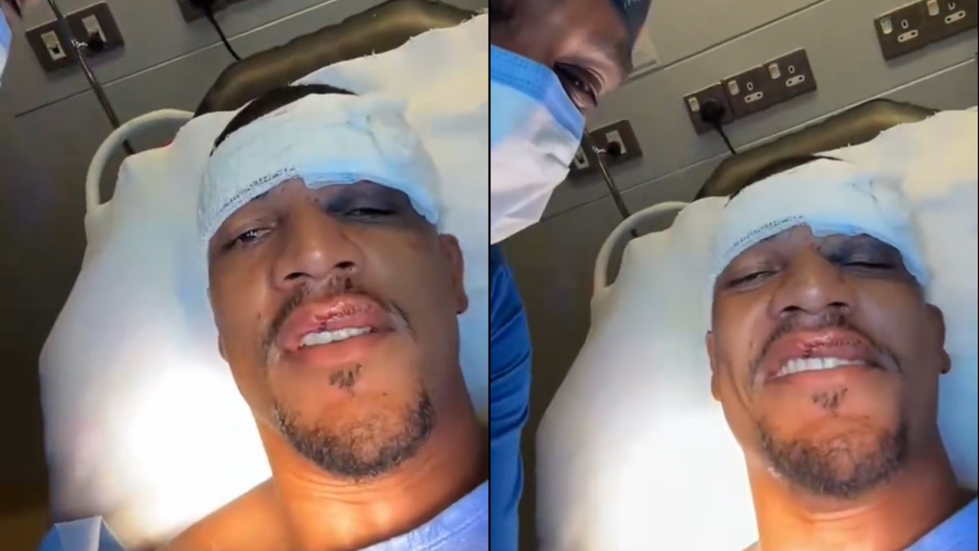 Jogador brasileiro precisou de 30 pontos na boca após sofrer chute no rosto em jogo da Champions asiática; vídeo