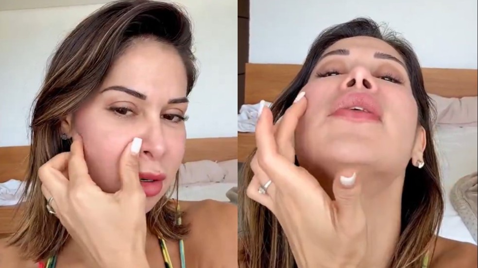 Maíra Cardi remove parte da bochecha após uso de substância altamente arriscada — Foto: Reprodução/Instagram