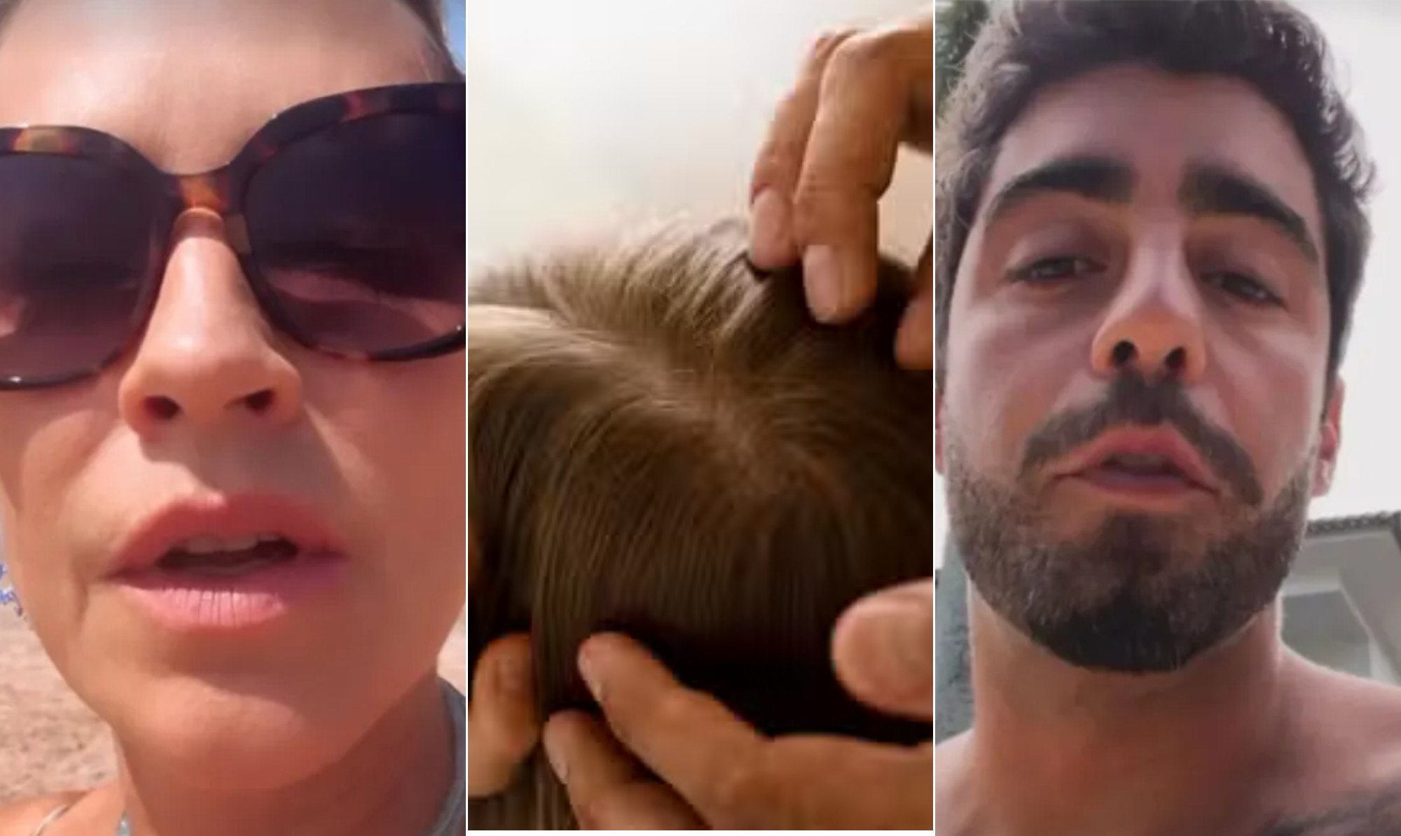 Piolho: remédio, contágio, por que a cabeça coça... Tudo sobre o inseto que 'perturba' Luana Piovani e Pedro Scooby