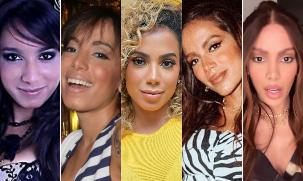 Antes e depois de Anitta: as várias transformações no rosto da cantora ao longo do tempo — Foto: Reprodução/Instagram