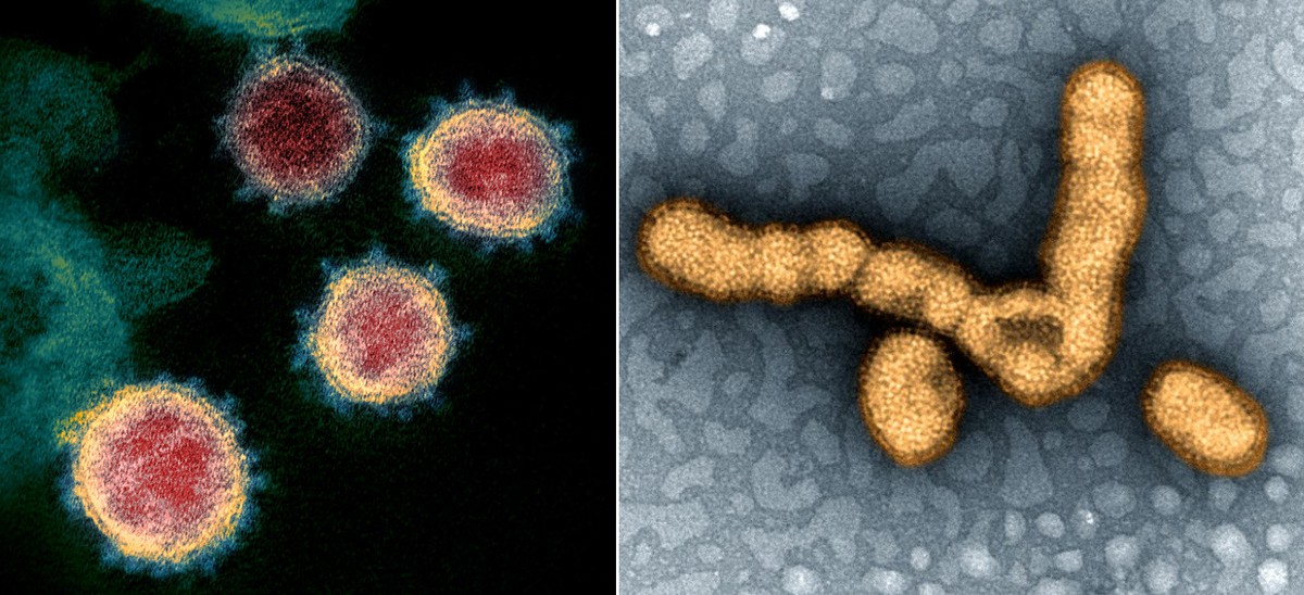&Eacute; poss&iacute;vel pegar v&aacute;rios v&iacute;rus ao mesmo tempo? Entenda o que acontece nessa situa&ccedil;&atilde;o
