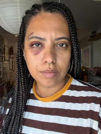 Influenciadora é agredida em roda de samba na Lapa