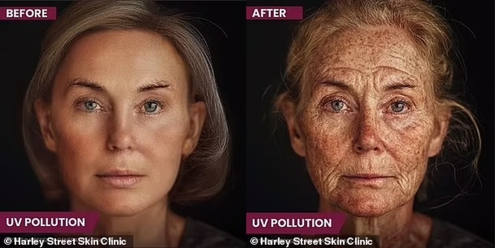 Ação do sol na pele do rosto — Foto: Reprodução