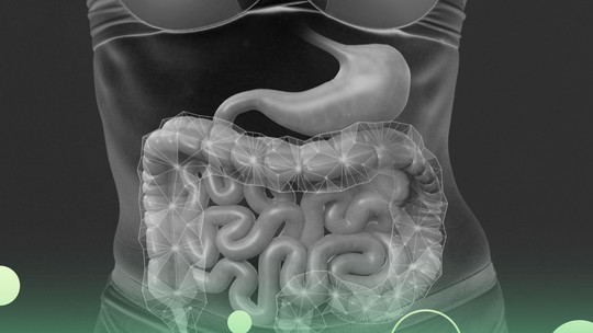 Doença de Crohn, assunto