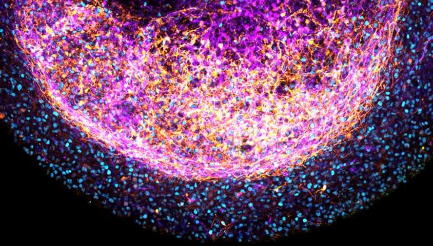 Uma imagem ampliada de uma parte de um organoide do cérebro fetal humano.