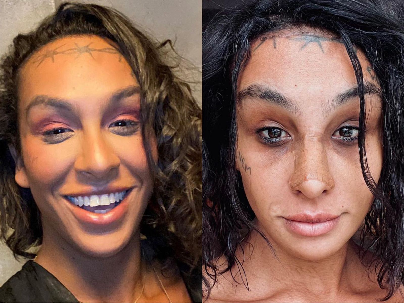 A cantora e atriz Linn da Quebrada foi submetida a uma cirurgia de afirmação de gênero. Ela ainda está em processo de cicatrização — Foto: Reprodução/Instagram