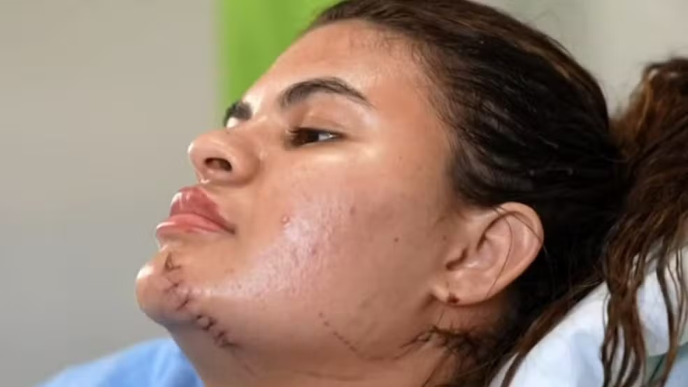 Jovem que teve mãos decepadas por cunhado diz temer perder a comunicação com a mãe surda