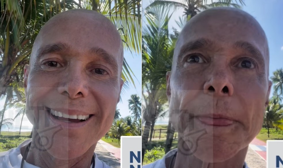 O cantor Netinho aparece com cabelo raspado devido a tratamento de câncer — Foto: Reprodução/Instagram