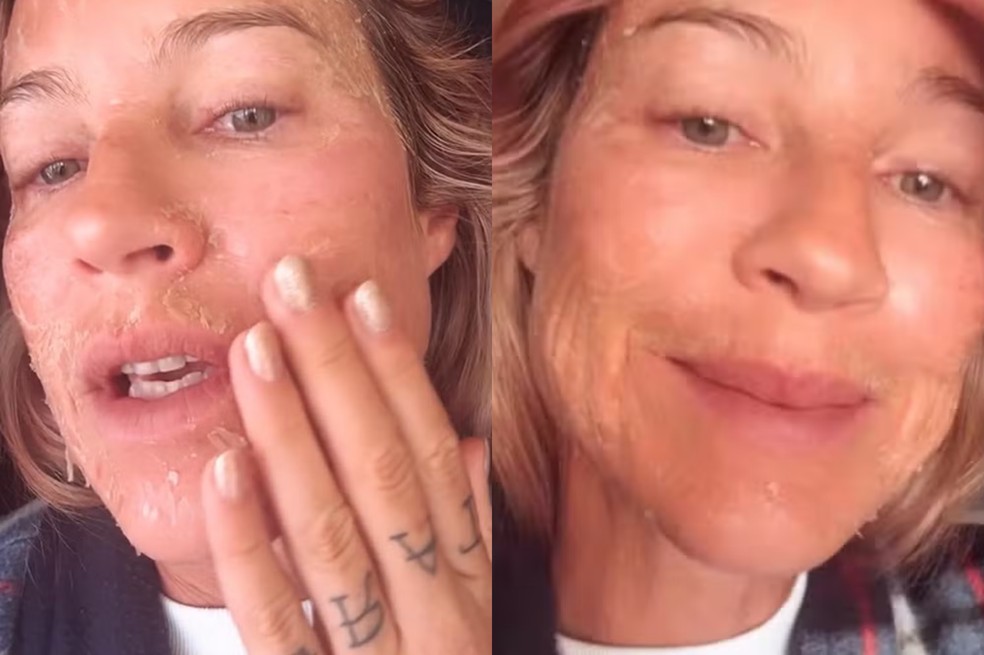 Luana Piovani surge com rosto descamando e chama atenção nas redes — Foto: Reprodução Instagram
