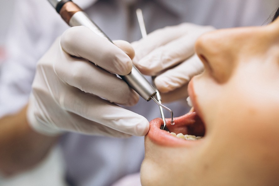 Cinco informações que os dentistas gostariam que todos soubessem