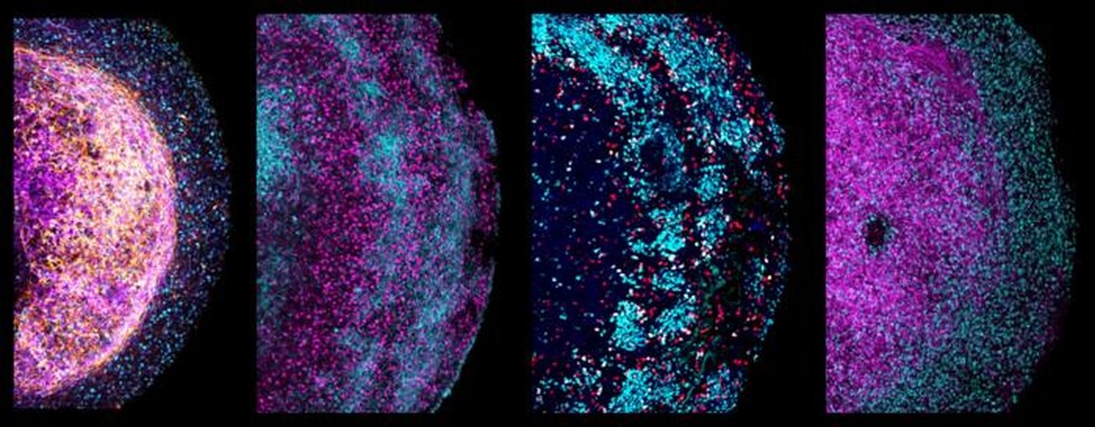Quatro imagens ampliadas de partes de diferentes organoides do cérebro fetal humano. — Foto: Divulgação / Princess Máxima Center, Hubrecht Institute/B Artegiani, D Hendriks, H Clevers