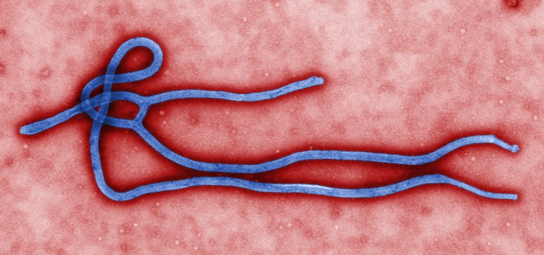 Exames descartam ebola em um dos casos suspeitos no Brasil
