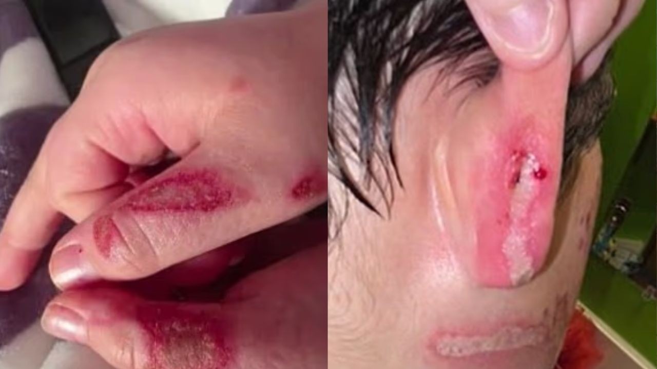 'Trend': Menino de 9 anos sofre queimaduras ap&oacute;s seguir desafio do TikTok com micro-ondas nos EUA