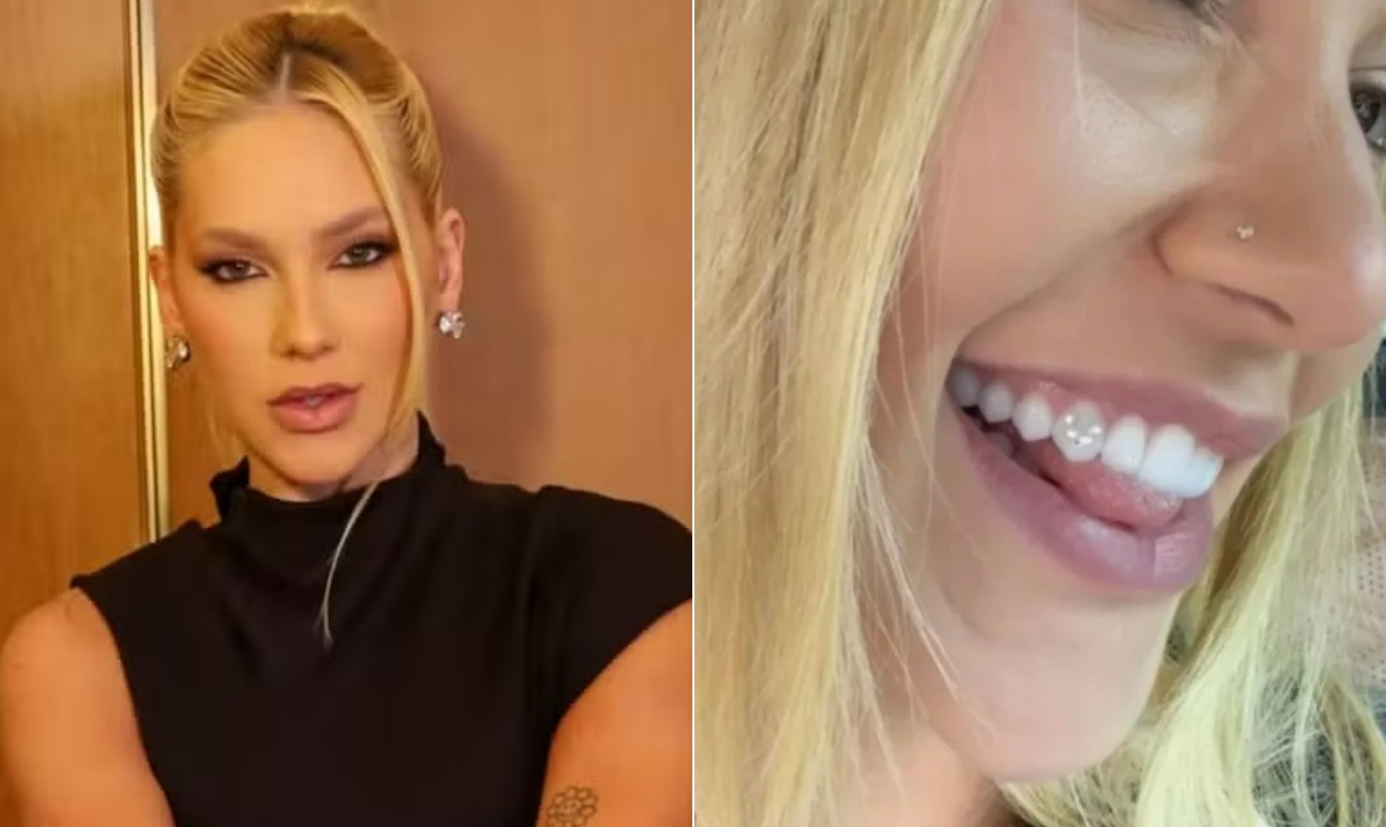 Diamante no dente: quais os riscos de procedimento de Virginia Fonseca após fazer um 'V' de Vini Jr. - Foto
