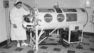 Pulmão de aço em 1960 nos Estados Unidos. — Foto: CDC Public Health Image Library