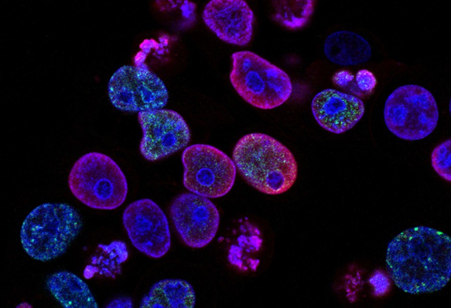 Células de câncer colorretal.