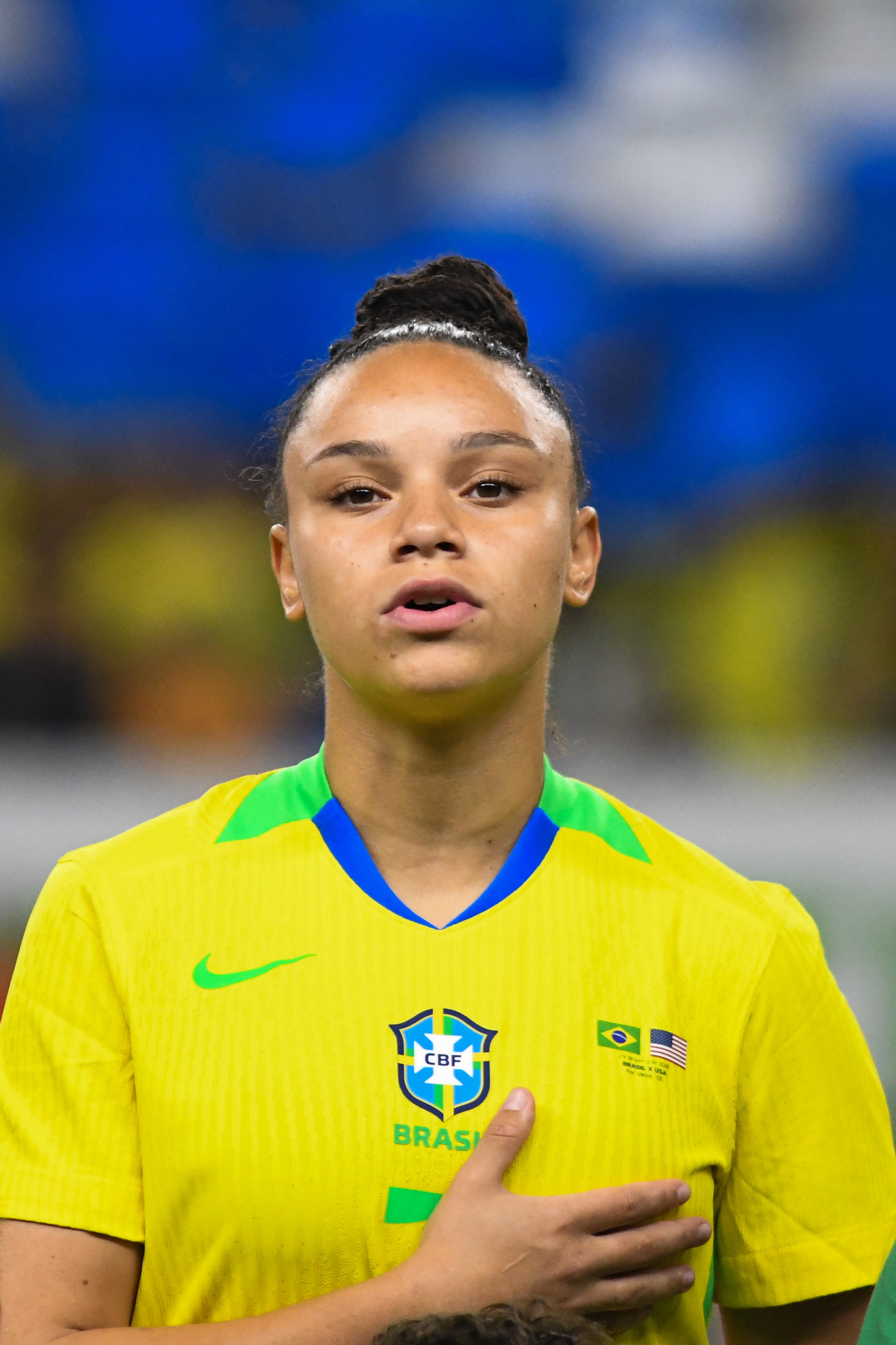 Dudinha, da seleção brasileira, confirma lesão de LCA após d