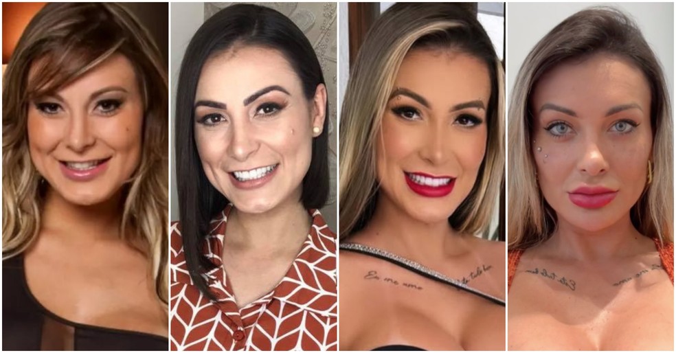 Before and after Andressa Urach collects more than 30 surgical and cosmetic procedures — Photo: Reproduction/Instagram @aandressaurach / Record TV
