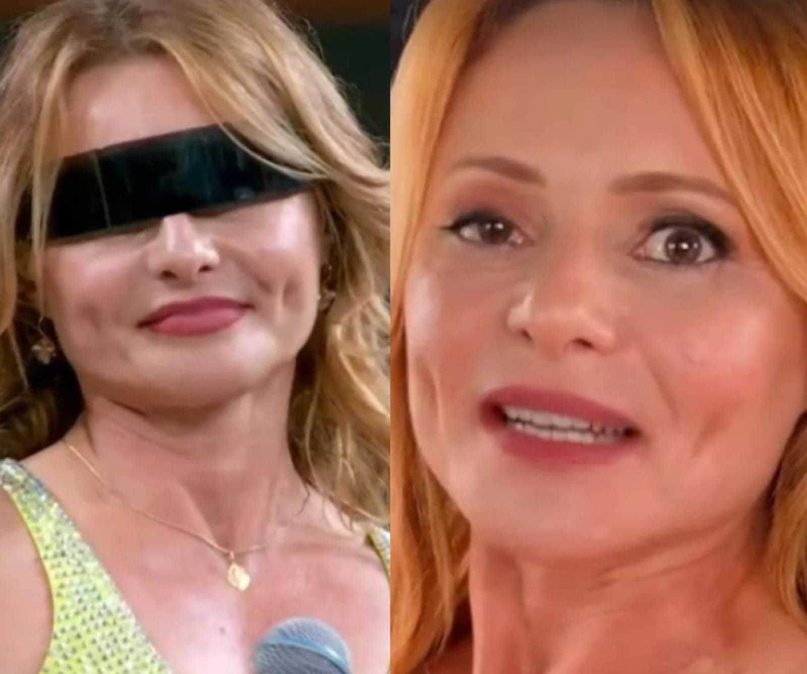 Rita Guedes conta que quase perdeu a visão após complicações de cirurgia no olho: 