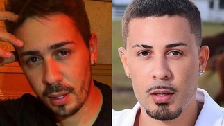 Carlinhos Maia retirou harmonização facial — Foto: Reprodução Instagram