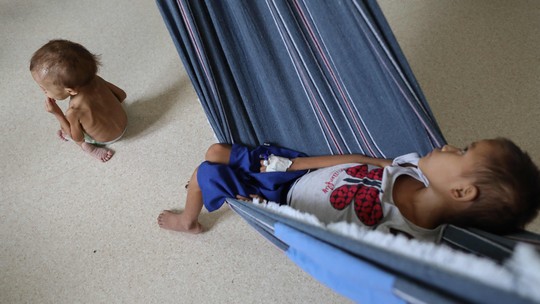 Ao menos 45 crianças ianomâmis estão internadas com quadro de desnutrição grave