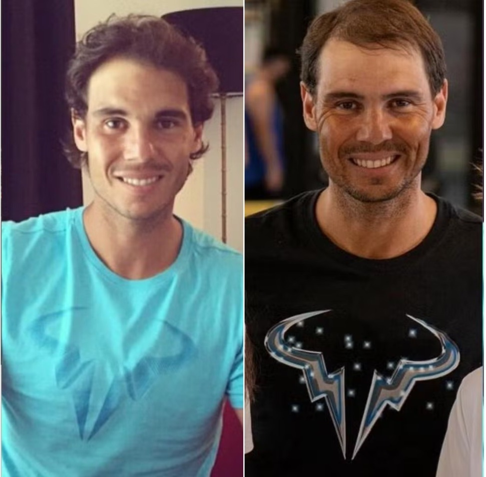 O tenista Rafael Nadal, que já teve longas madeixas, agora chama atenção por estar perdendo cabelo — Foto: Reprodução / Redes sociais