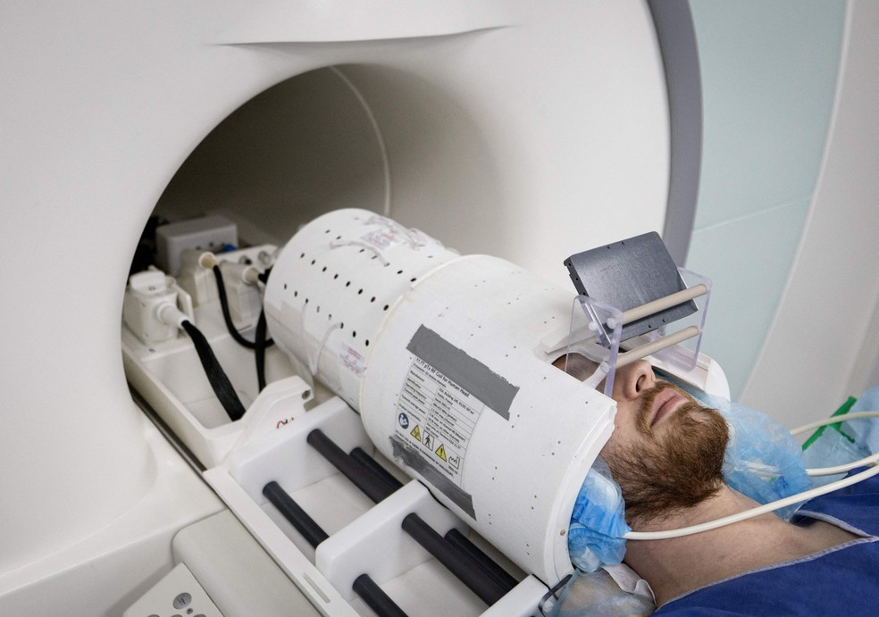 Voluntário tem cérebro examinado na máquina Iseult Magneton 11.7 T MRI, na França — Foto: ALAIN JOCARD / AFP