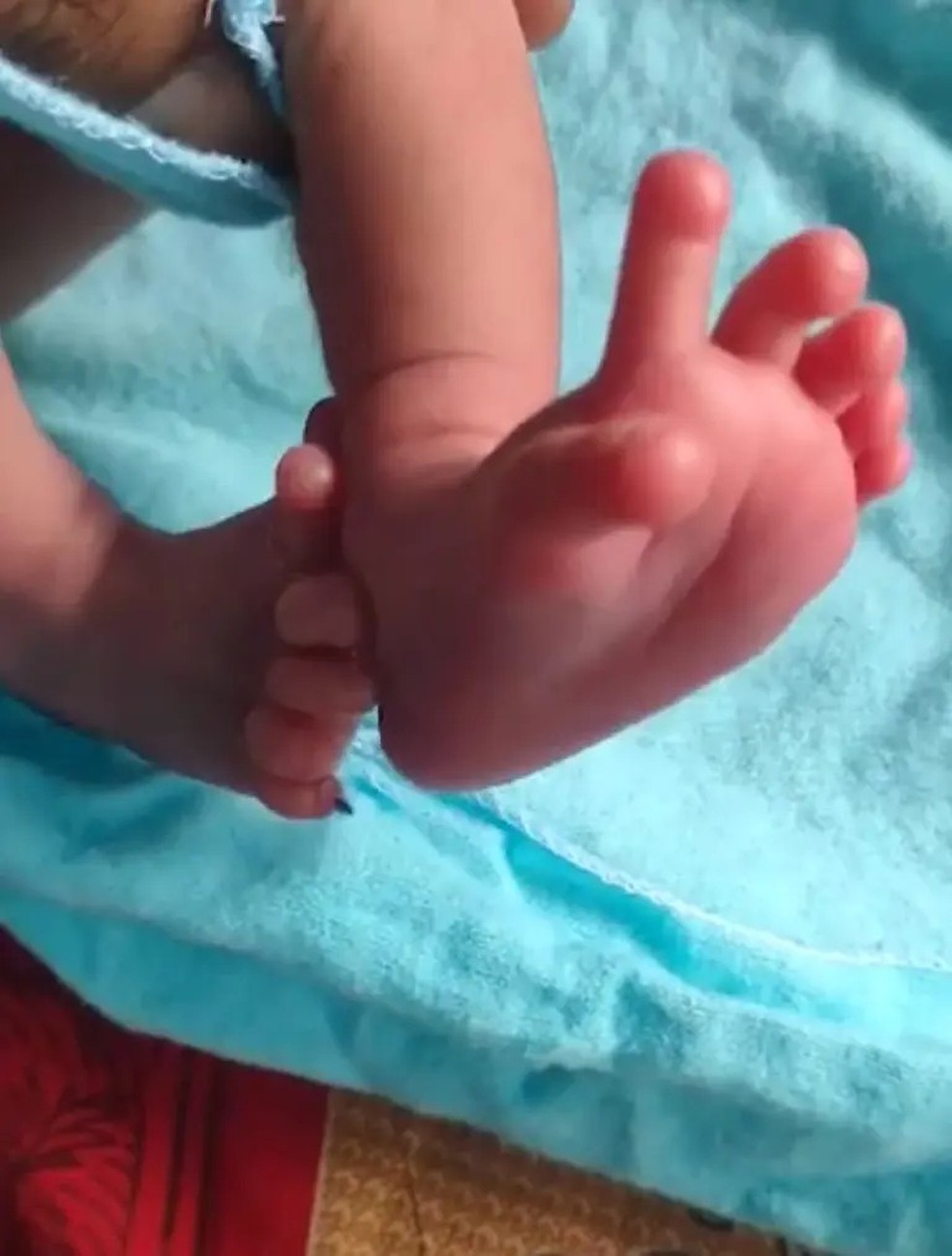 Pé da bebê que nasceu com 26 dedos ao todo — Foto: Reprodução