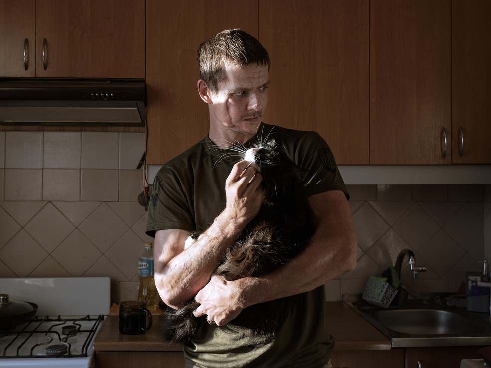 Volodymyr Melnyk, que passou por mais de 50 cirurgias, em sua casa em Kiev, Ucrânia — Foto: Laetitia Vancon/The New York Times
