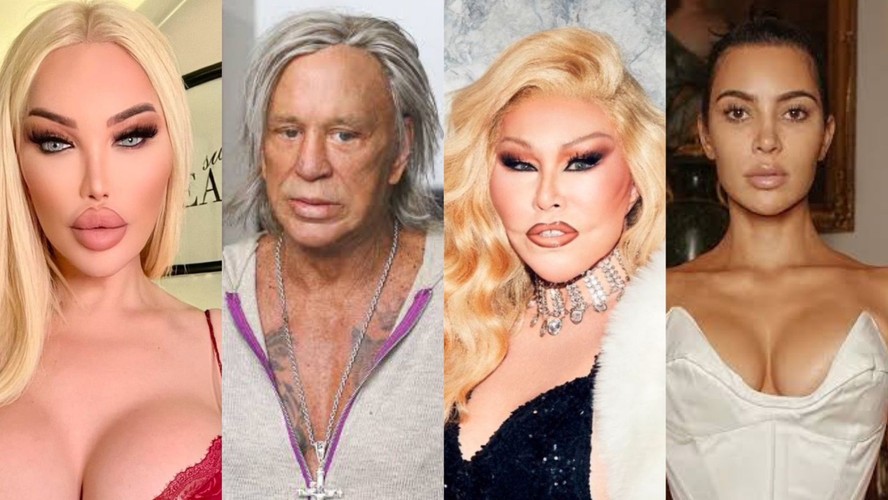 Tendências de Beleza: Especialista Comenta sobre Cirurgias Estéticas de Celebridades