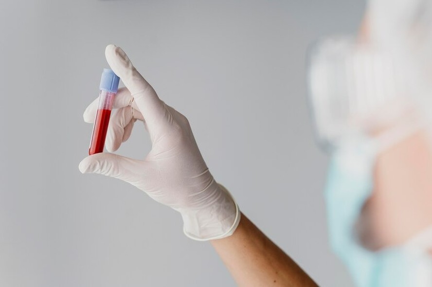 Exame de sangue pode evitar cirurgias para fazer biópsias de câncer no cérebro