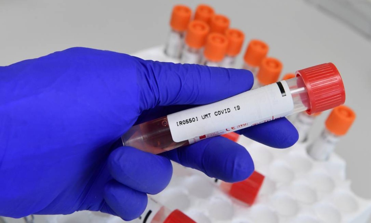 Um trabalhador médico segura uma amostra de esfregaço de um teste de COVID-19 em um laboratório no centro de testes central de Milão (CDI), onde milhares de esfregaços são testados a cada dia, em Milão, Itália — Foto: JENNIFER LORENZINI / REUTERS