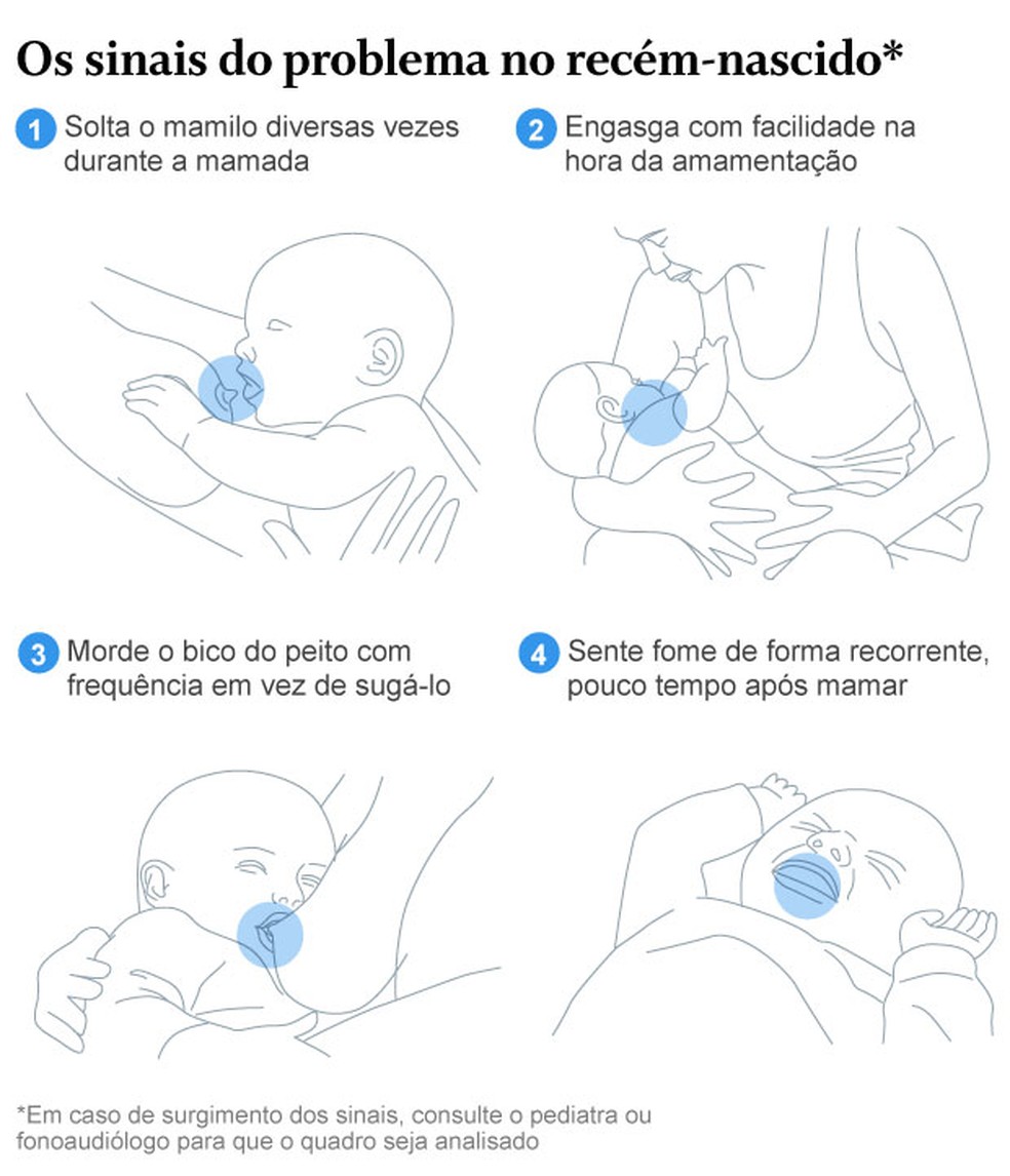 Dicas para diagnosticar problemas de amamentação no bebê — Foto: Editoria de Arte
