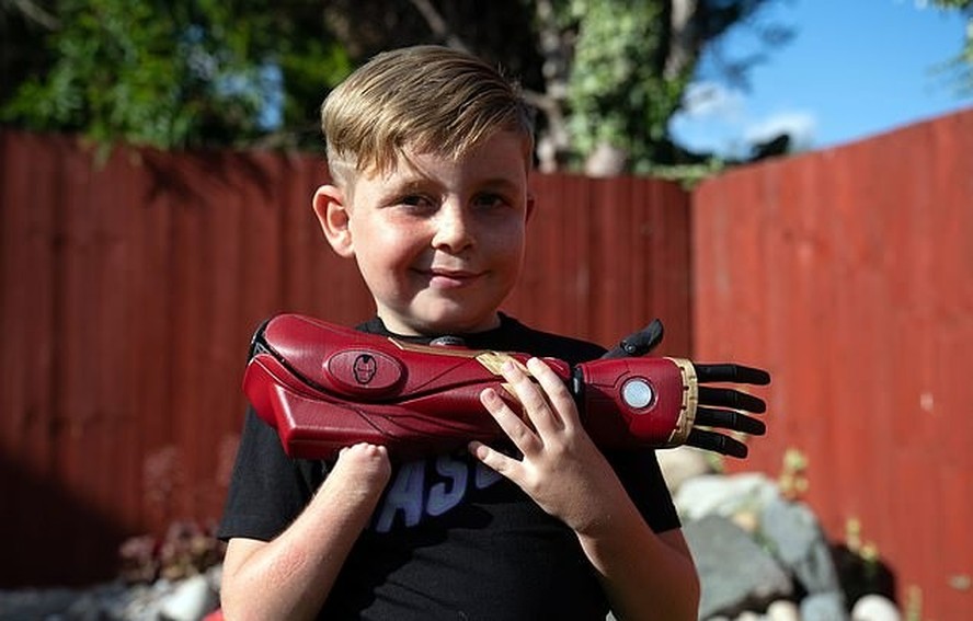 Britânico nascido sem mão obtém braço biônico inspirado em jogo
