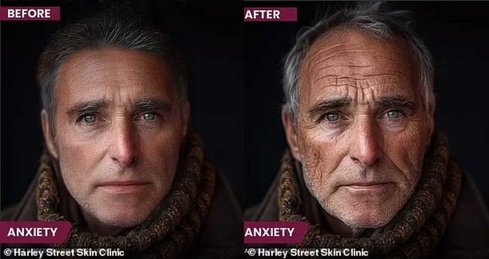 Efeitos da ansiedade e estresse sobre a pele — Foto: Reprodução