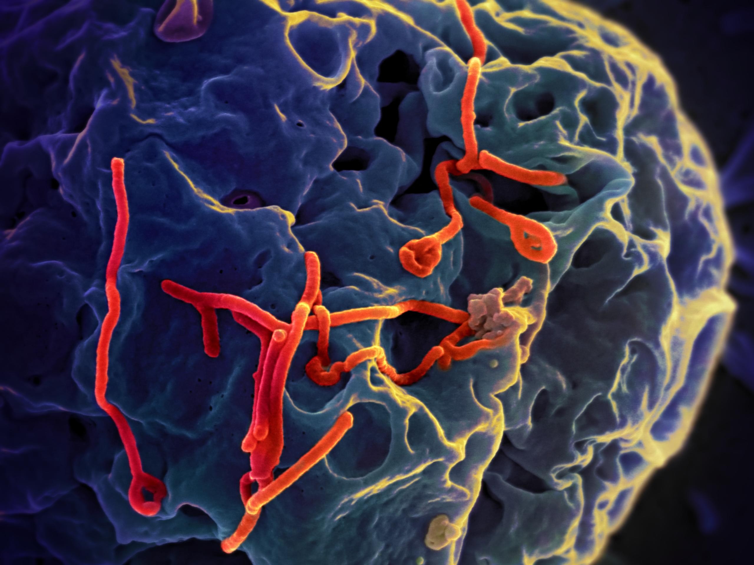 Epidemia de ebola na República Democrática do Congo: quatro mortos são confirmados, e outros 65 óbitos são investigados