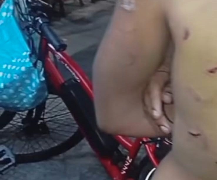 Polícia investiga caso de jovem que teria sido torturado por duas mulheres durante anos em Santa Teresa