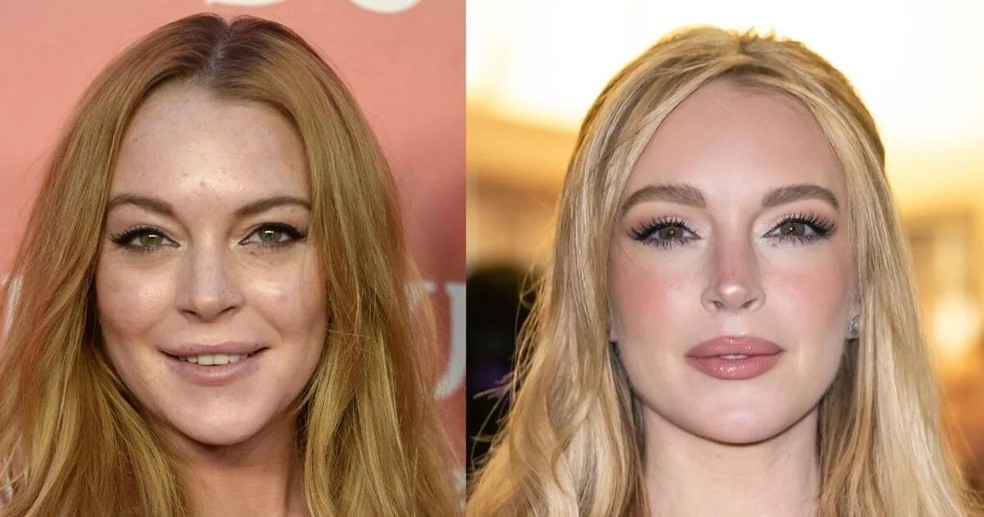 Lindsay Lohan reaparece com aparência mais suave e natural após reverter excessos estéticos e adotar procedimentos sutis de rejuvenescimento — Foto: Getty Images/@lindsaylohan