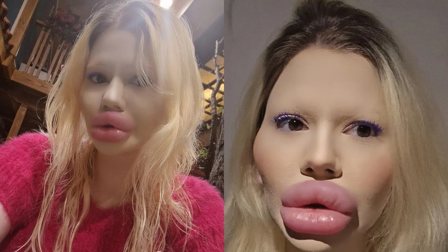 saiba-quem-a-mulher-que-gastou-quase-r-150-mil-para-ter-os-maiores