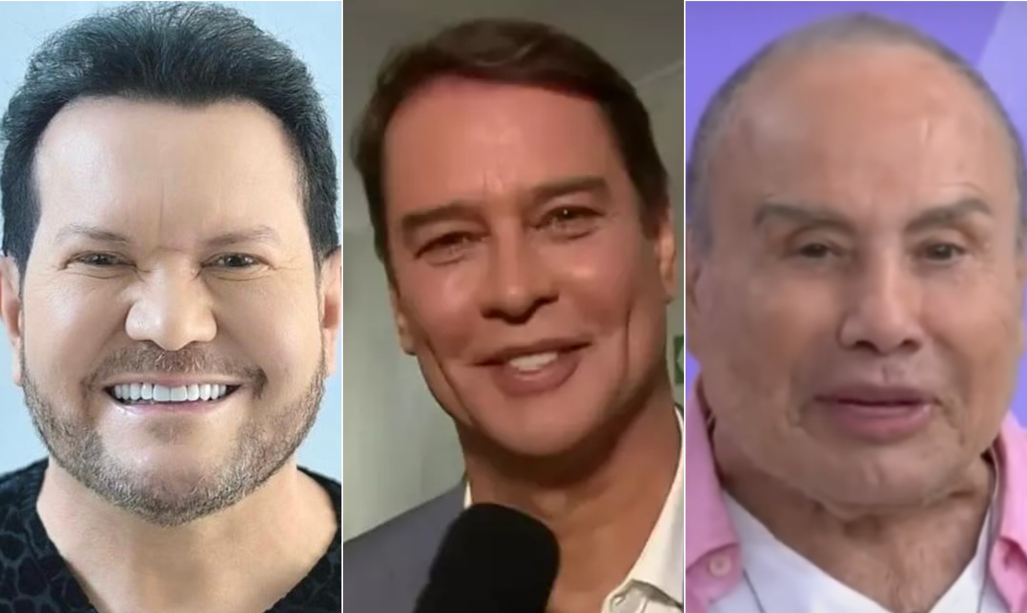 Ximbinha, Marcello Antony e Stenio Garcia: relembre famosos que chamaram atenção na web com harmonização facial