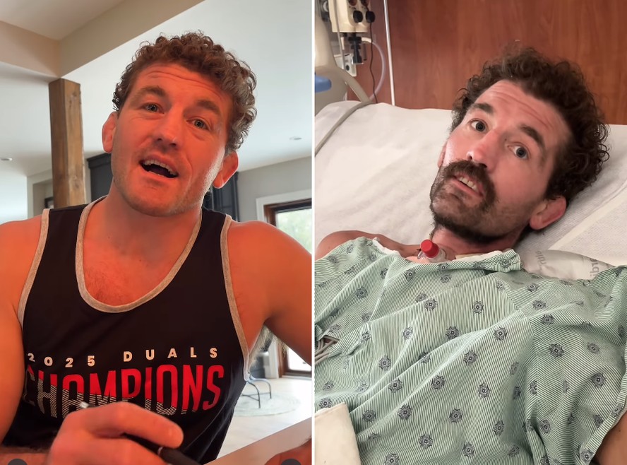 Ex-lutador do UFC aparece 'irreconhecível' após transplante de pulmão ...