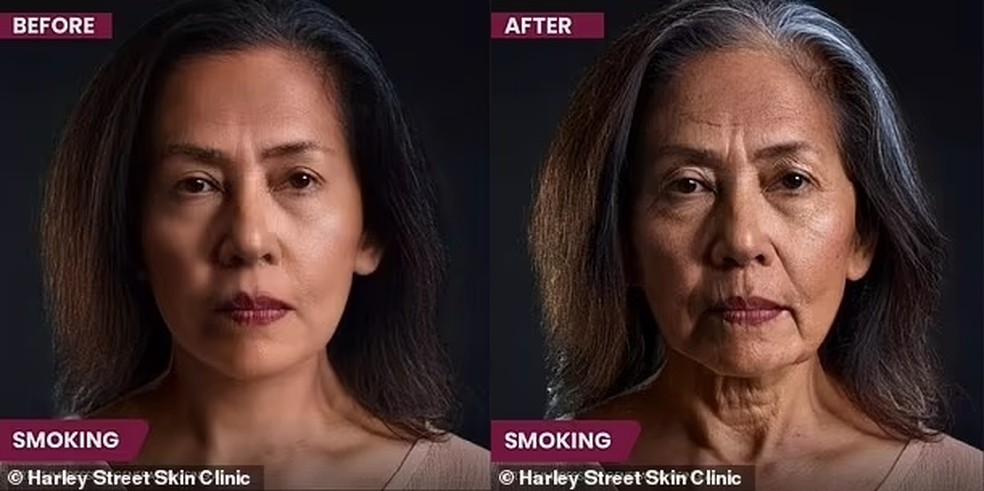Fumar provoca diversos sinais de envelhecimento — Foto: Reprodução