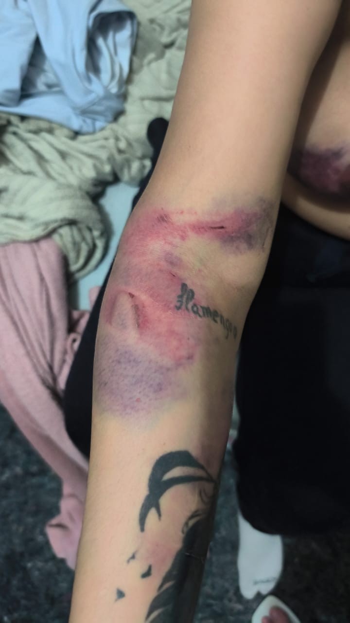 Detenta é agredida no Talavera Bruce e defesa recorre à Justiça por exame de corpo de delito