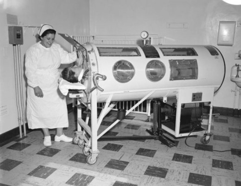 Pulmão de aço em 1960 nos Estados Unidos. — Foto: CDC Public Health Image Library
